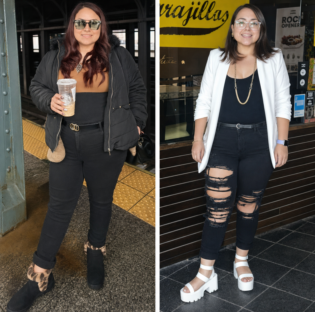 Gastric sleeve before and after, patient 6 - Allure RT MX