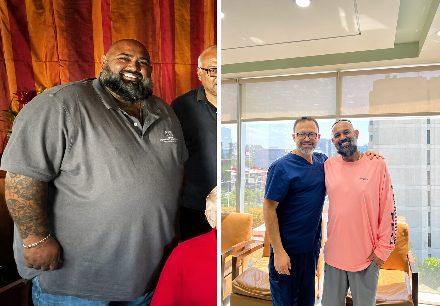 Gastric sleeve before and after, patient 8 - Allure RT MX